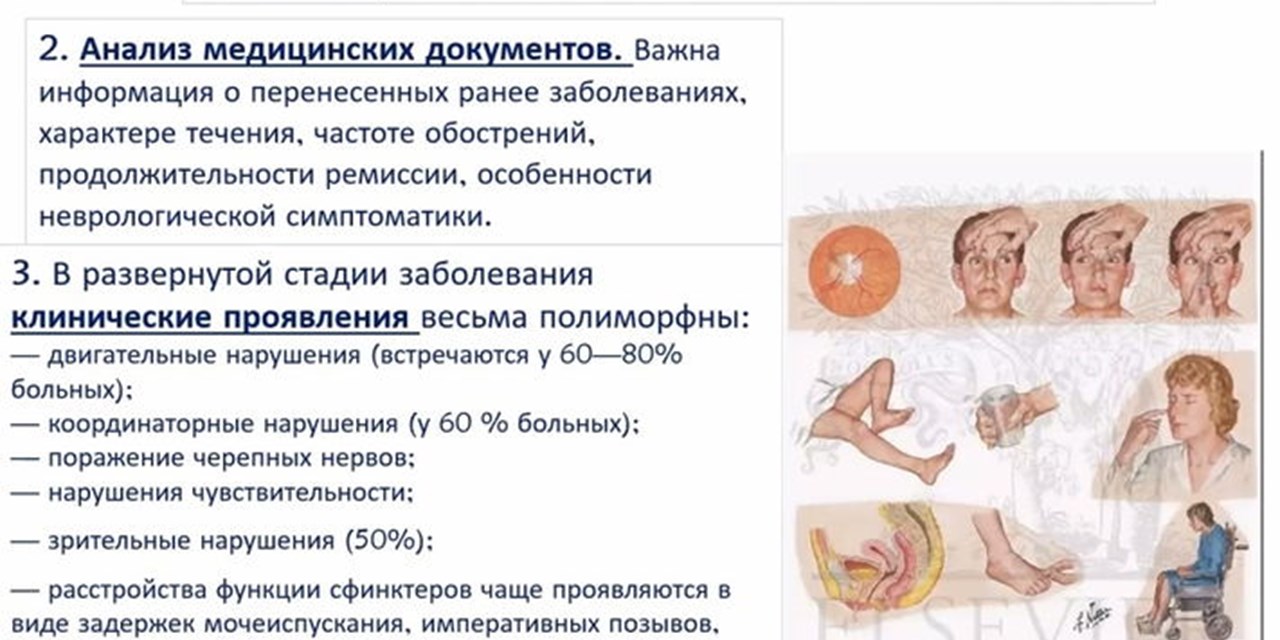 16.12.2020 Иркутск. Школа правовых знаний для пациентов: «Медико-социальная экспертиза при рассеянном склерозе»