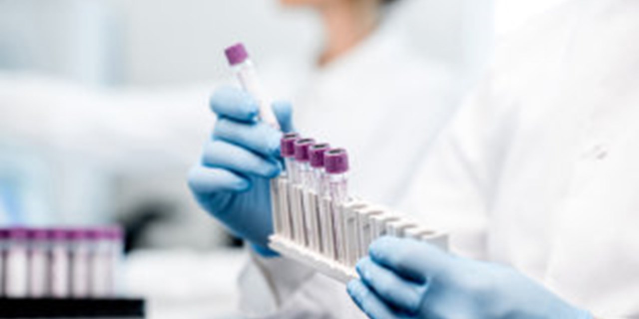 31.01.2020 Опрос. Гепатит