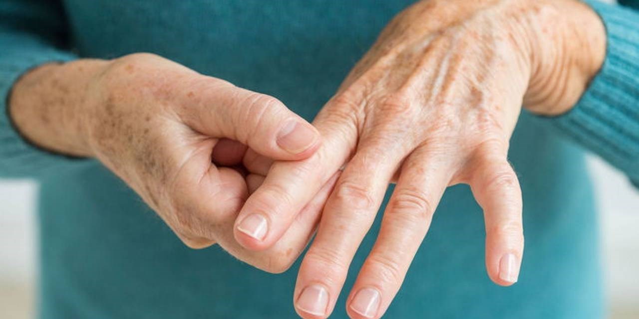 29.05.2019 Ростов-на-Дону. Консилиум по проблематике псориатического артрита