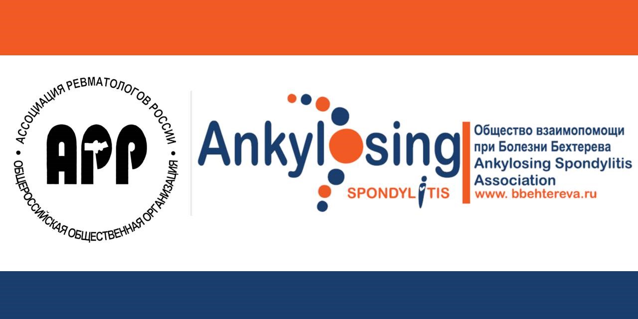 Анонс. 30 мая -13 июня 2019 в Курске откроется выставка скульптур «Болезнь молодых, или жизнь с болью»